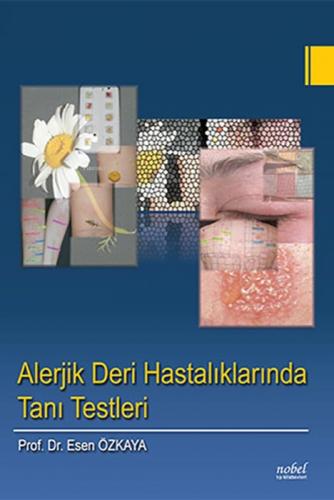 Alerjik Deri Hastalıklarında Tanı Testleri  Frontansicht 1