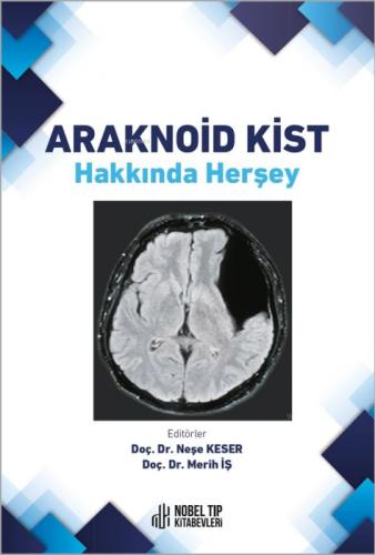 Araknoid Kist Hakkında Herşey  Frontansicht 1