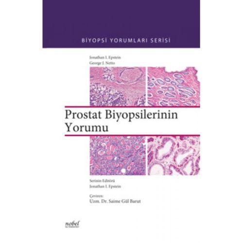 Prostat Biyopsilerinin Yorumu  Frontansicht 1