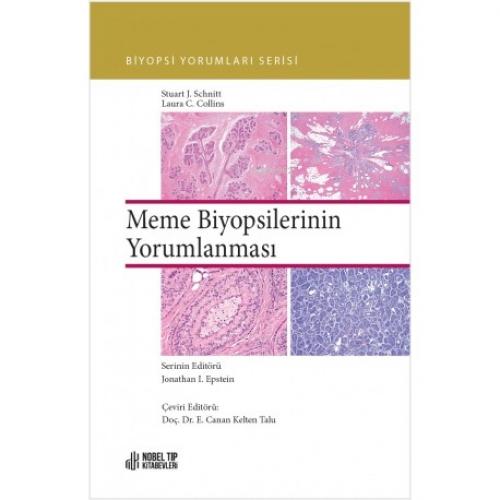 Biyopsi Yorumları Serisi:;Meme Biyopsilerinin Yorumlanması  Frontansicht 1