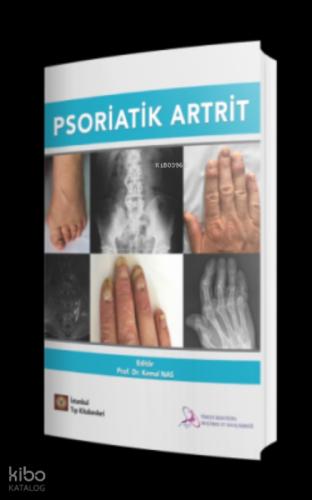 Psoriatik Artrit  Frontansicht 1