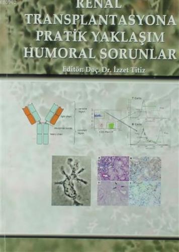 Renal Transplantasyona Pratik Yaklaşım Humoral Sorunlar  Frontansicht 1
