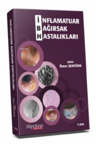 İnflamatuar Bağırsak Hastalıkları  Frontansicht 1