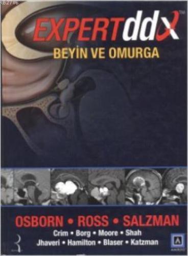 Expert DDX Beyin ve Omurga  Frontansicht 1