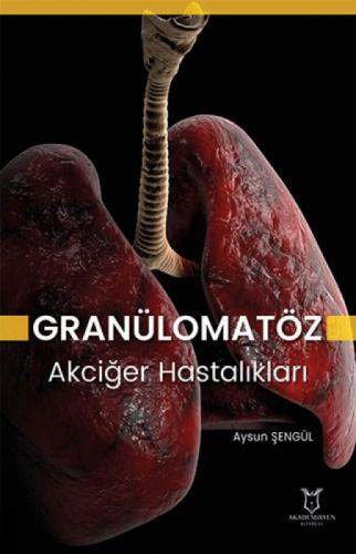 Granülomatöz Akciğer Hastalıkları  Frontansicht 1