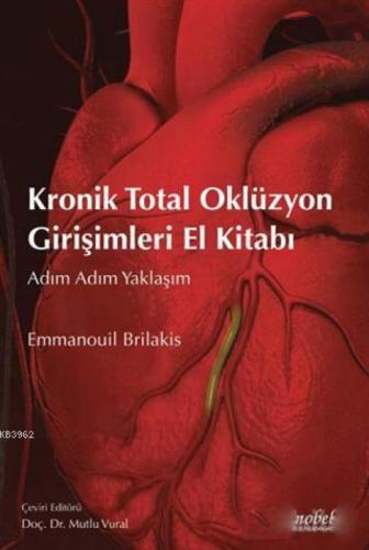 Kronik Total Oklüzyon Girişimleri El Kitabı  Frontansicht 1