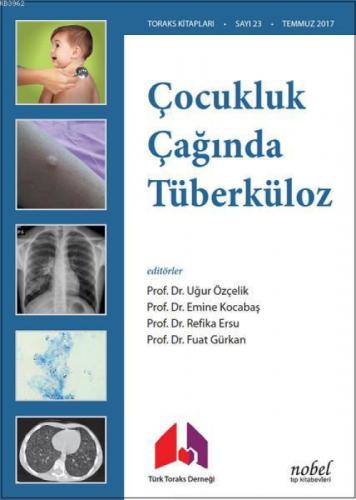 Çocukluk Çağında Tüberküloz  Frontansicht 1