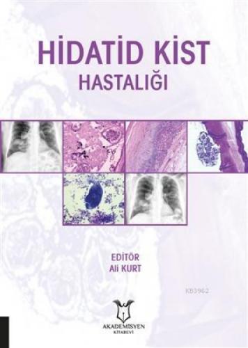 Hidatid Kist Hastalığı  Frontansicht 1