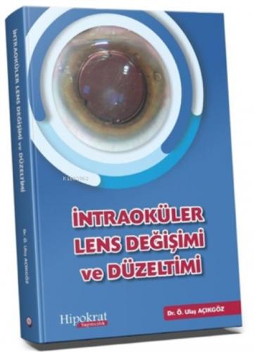 İntraoküler Lens Değişimi ve Düzeltimi  Frontansicht 1