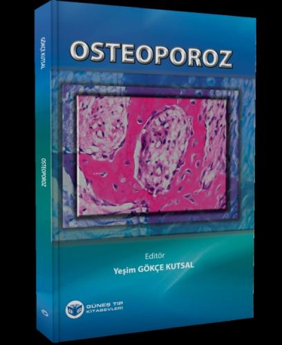 Osteoporoz  Frontansicht 1