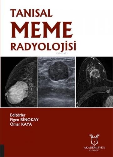 Tanısal Meme Radyolojisi  Frontansicht 1