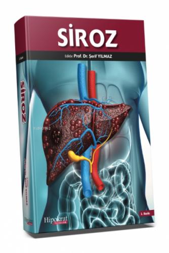 Siroz  Frontansicht 1