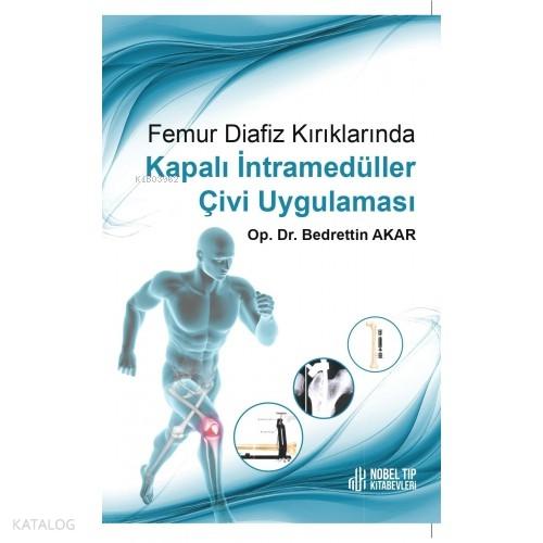 Femur Diafiz Kırıklarında Kapalı İntramedüller Çivi Uygulaması  Frontansicht 1