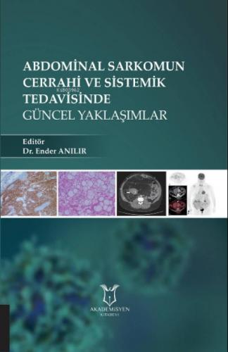 Abdominal Sarkomun Cerrahi ve Sistemik Tedavisinde Güncel Yaklaşımlar  Frontansicht 1