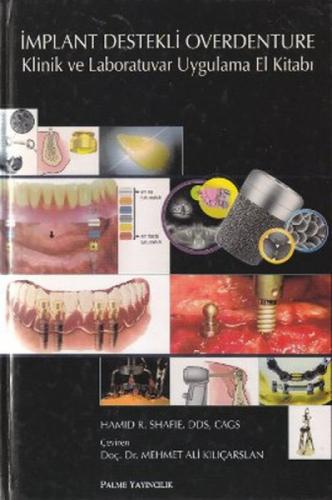 İmplant Destekli Overdenture Klinik ve Laboratuvar Uygulama El Kitabı  Frontansicht 1