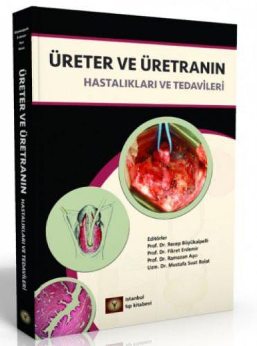 Üreter ve Üretranın Hastalıkları ve Tedavileri  Frontansicht 1