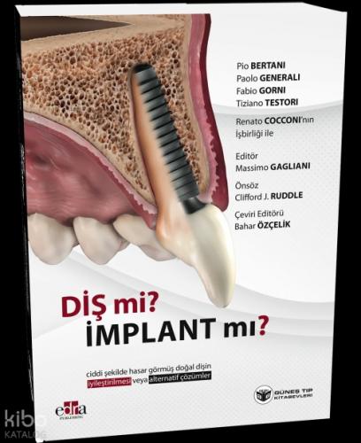 Diş mi? İmplant mı? Doğal Dişin Korunması veya İmplant Çözümleri Üzerine Kapsamlı Rehber  Frontansicht 1