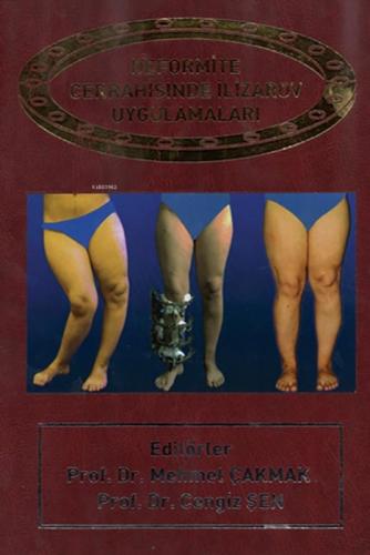 Deformite Cerrahisinde İlizarov Cerrahisi  Frontansicht 1