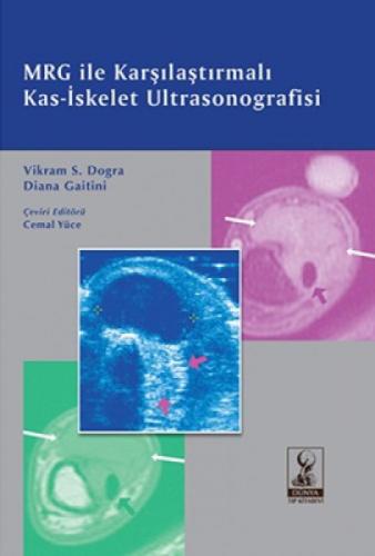 MRG İle Karşılaştırmalı Kas-İskelet Ultrasonografisi  Frontansicht 1